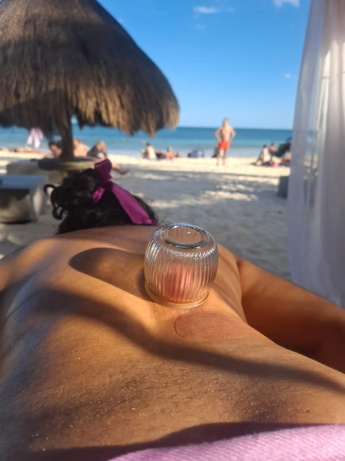 Terapia con ventosas