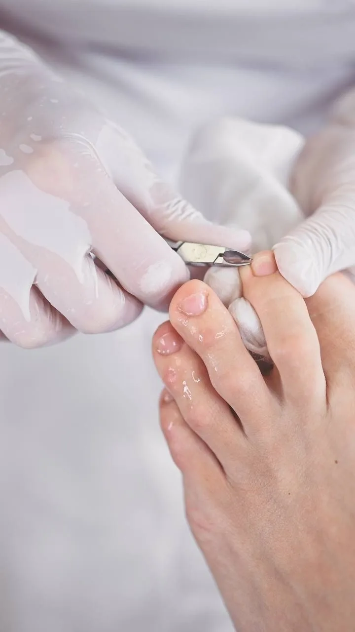 Quiropodia (Pedicure Clinico)