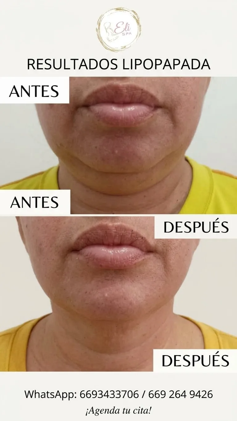 Lipopapada