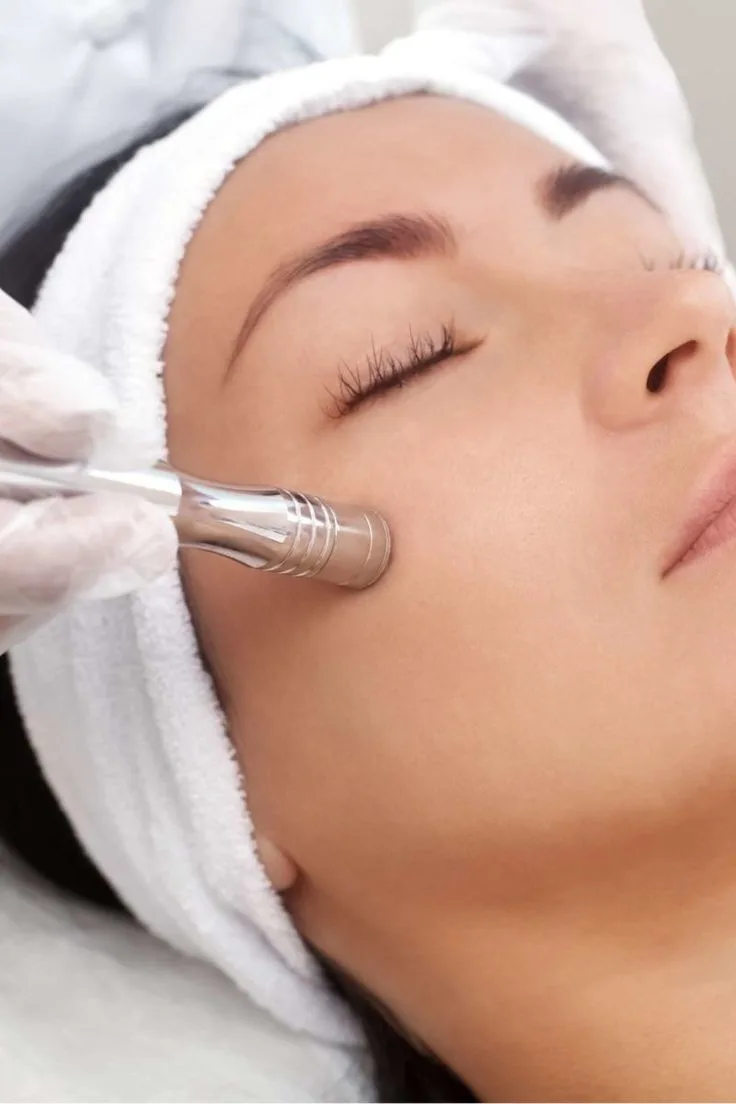 Microdermoabrasion facial