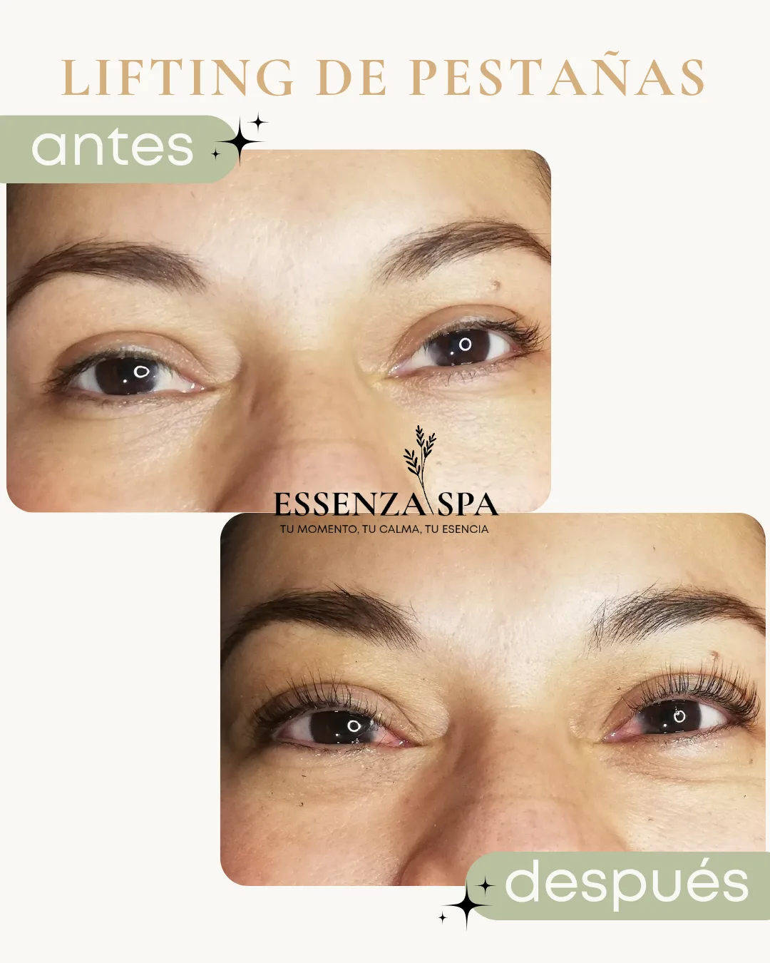 Lifting de pestañas